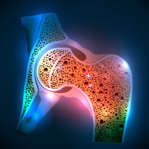 OSTEOPOROSI1